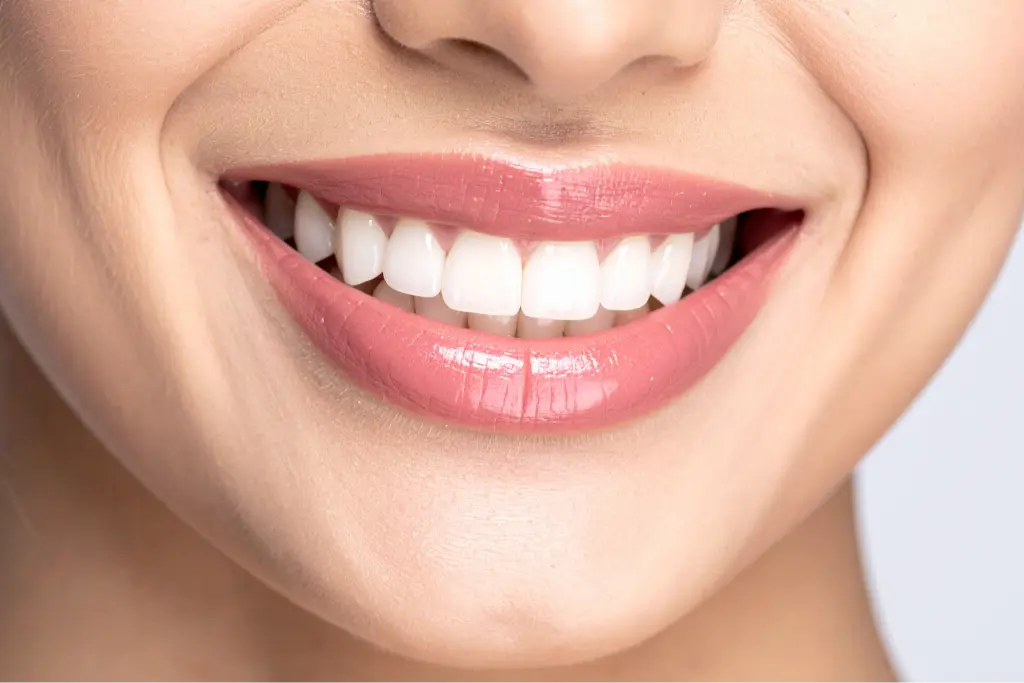 Invisalign FAQs at BeauDent Family Dental in Beaumont